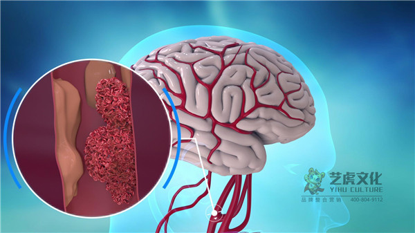 制作医学动画宣传